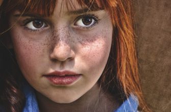 Сон Веснушки. К чему снятся веснушки толкование по сонникам